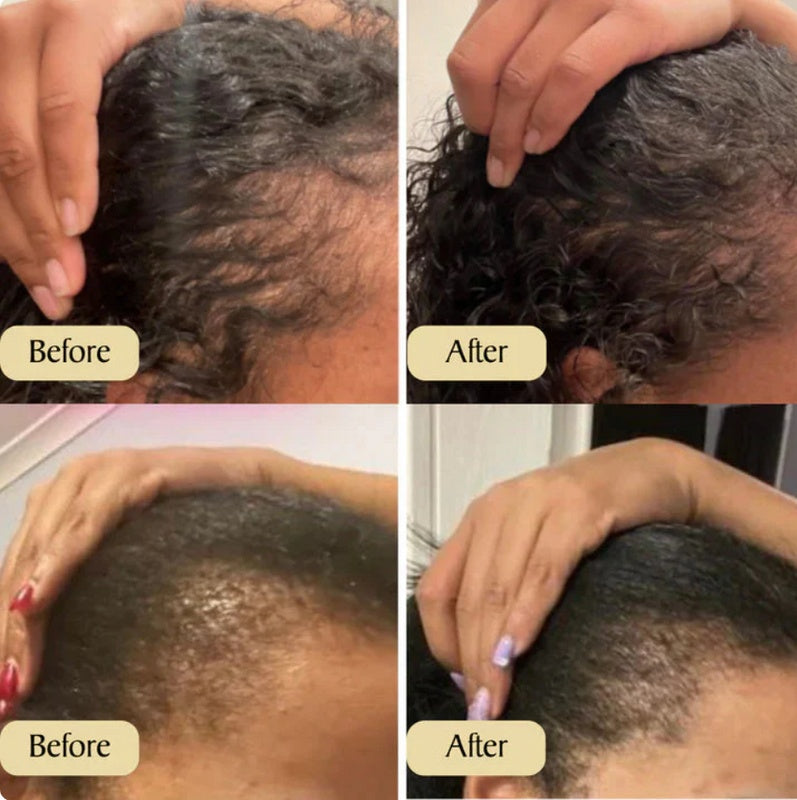 Hair Growth Oil – A 100% Natural Nourishing